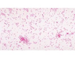 FD NEISSERIA SICCA W/MEDIA