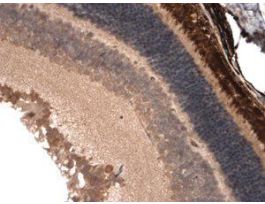 CNGA1-3 ANTIBODY 100UG