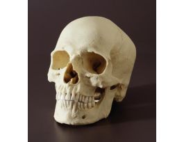 MODEL SKULL HUMAN ABORIGINE MALE.