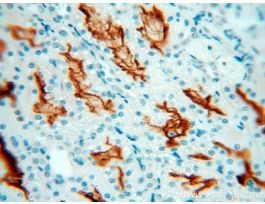 ANTI-MMECD10(POLYCLONAL) 18008-1-AP