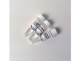 LAMBDA PROTEIN PHOSPHATASE