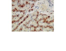 COPPER STAIN KIT 100RXN