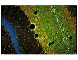 (FJC) DILUTE STAINING KIT TRIAL SIZE