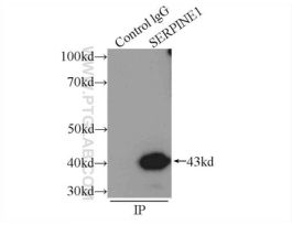 ANTI-PAI-1(POLYCLONAL)
