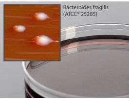 LKV AGAR REDUCIBLE F/ANAEROBES 15X100 MM