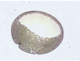 FROG-GASTRULA TYPICAL SAG. SECT. H&E