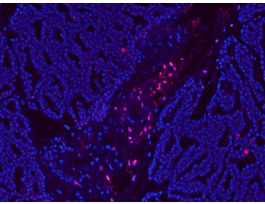 KIT TUNEL ASSAY APOP DETCN CF594 50RXN