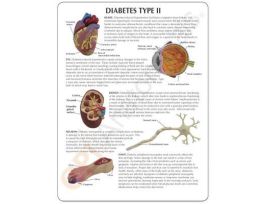 MODEL TYPE II DIABETES