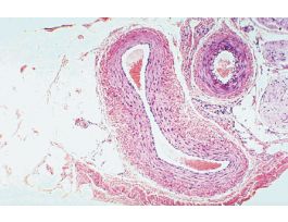 ARTERY & VEIN (CS) H&E MAMMAL
