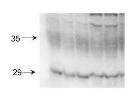 AQUAPORIN 2 ANTIBODY 100UL