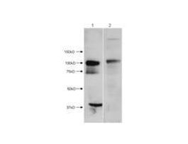 HDAC7 ANTIBODY 100 UG