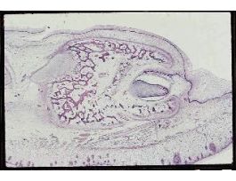 DENTINE FORMATION MAL (PIG FETUS)