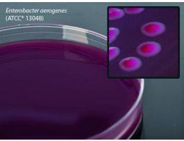 MEDIUM VIOLET RED BILE GLC AGR 18ML PK10