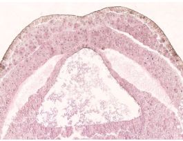 FROG-EARLY NEURALGROOVE(CS)4-LEVELSH&E