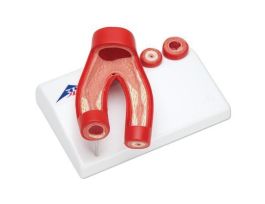 MODEL ARTERIOSCLEROSIS ON BASE