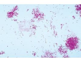 FD PSEUDOMONAS AERUGINOSA W/MEDIA