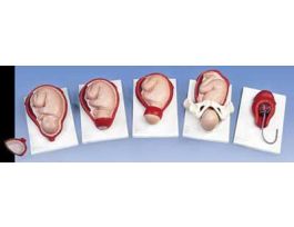 MODEL 5-STAGE BIRTH PROCESS