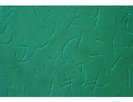 FD BACILLUS CEREUS (G+ ROD)