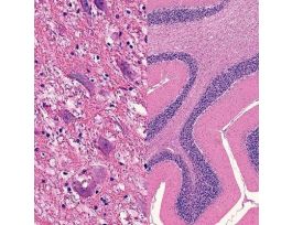 BRAIN-COMPOSITE (SECT) H&E (HUMAN)