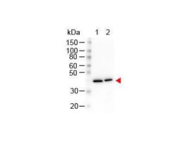 BETA ACTIN ANTIBODY 25UL