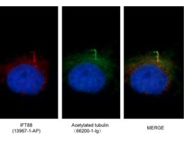ANTI-IFT88(POLYCLONAL)