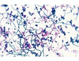 GRAM - & + ORGANISMS STAINED