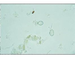 EIMERIA SP. OOCYSTS INFECES(SM)COCCIDIAN