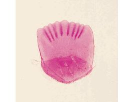 CTENOID SCALE (WM) SLIDE STAINED