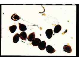 FERN SPORANGIA (WM) FS&FG SLIDE