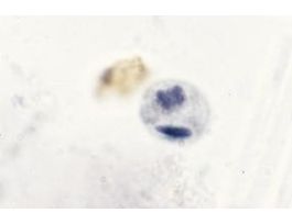 ENTAMOEBA HISTOLYTICA-CYSTS (WM) SLIDE