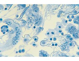 ANIMAL MEIOSIS (SQ) AC( CHORTHIPPUS)