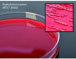 PLATE BLOOD AGAR 5% TSA 15X100MM PK10