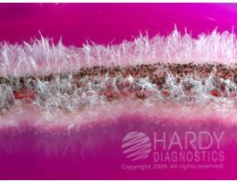 ROSE BENGAL AGAR W CHLORAMPHENICOL